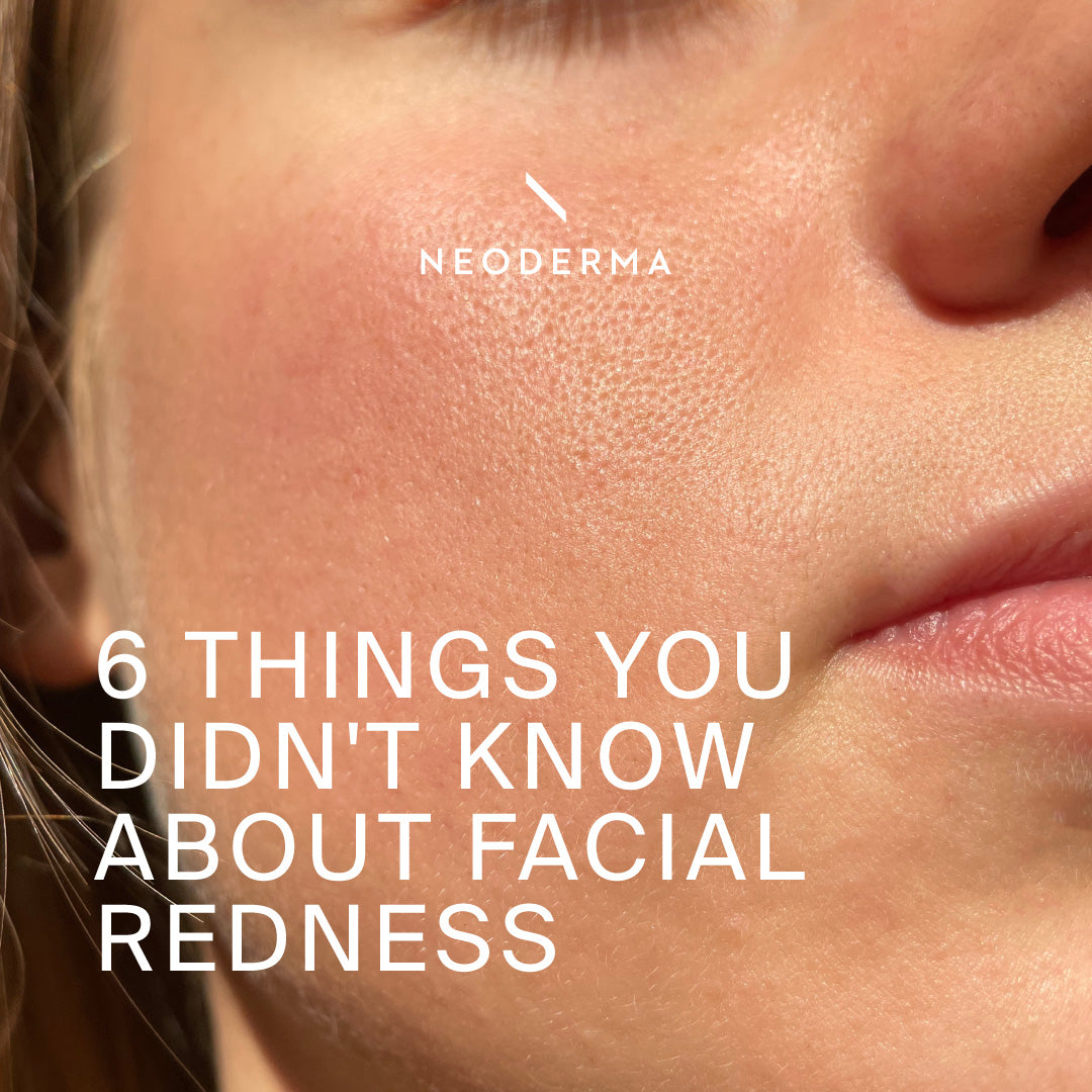 6 Things You Dind't Know About Facial Redness