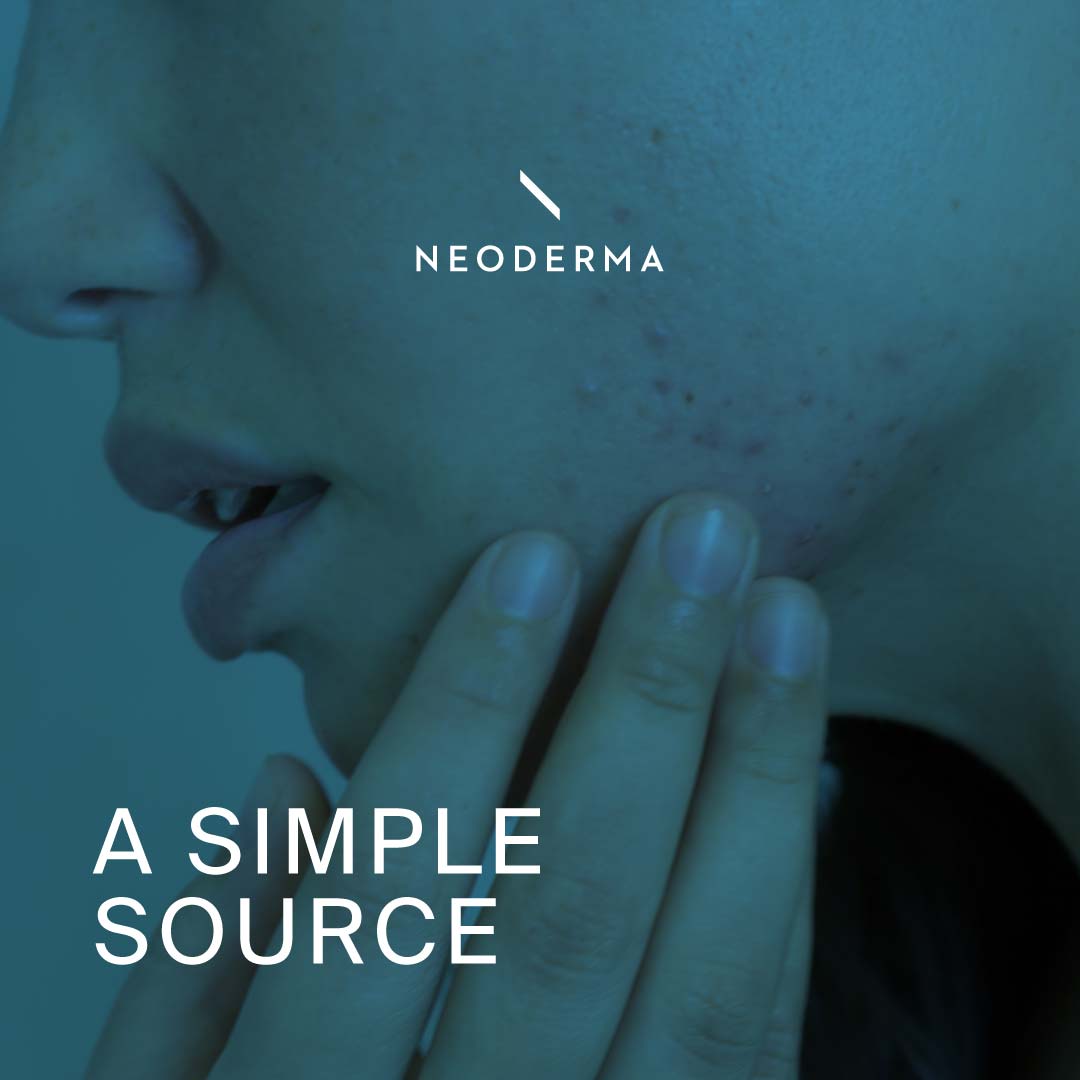 A Simple Source