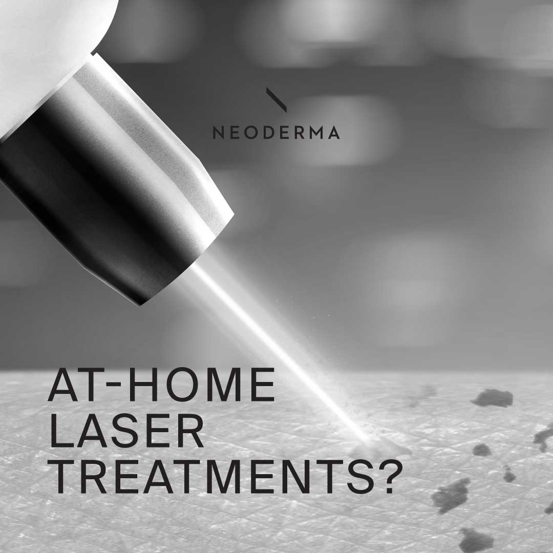At-Home Laser Treatments