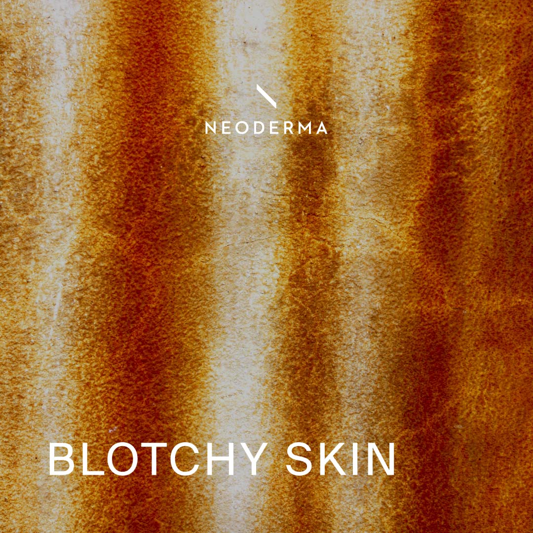 Blotchy Skin