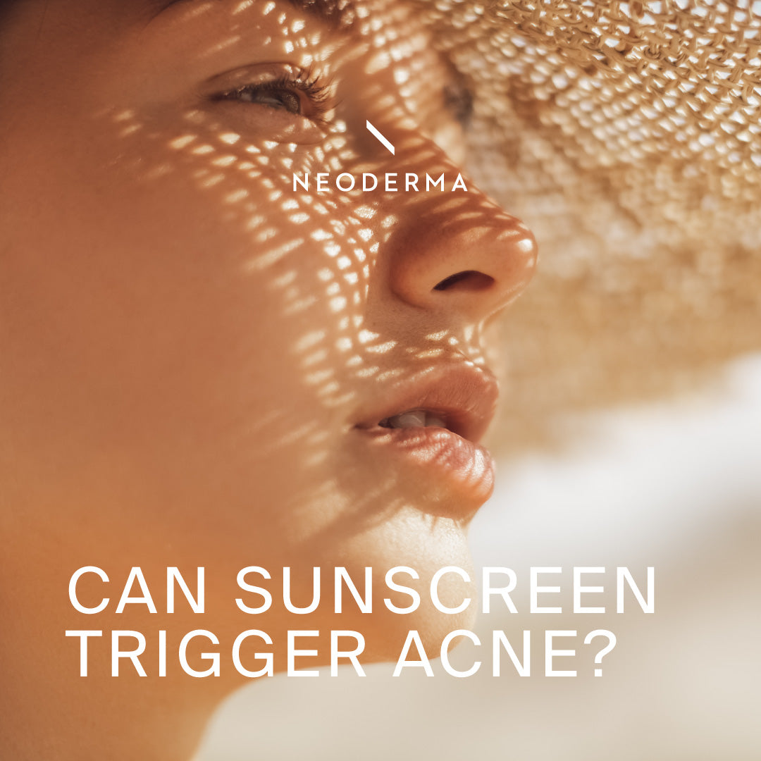 Can Sunscreen Trigger Acne?
