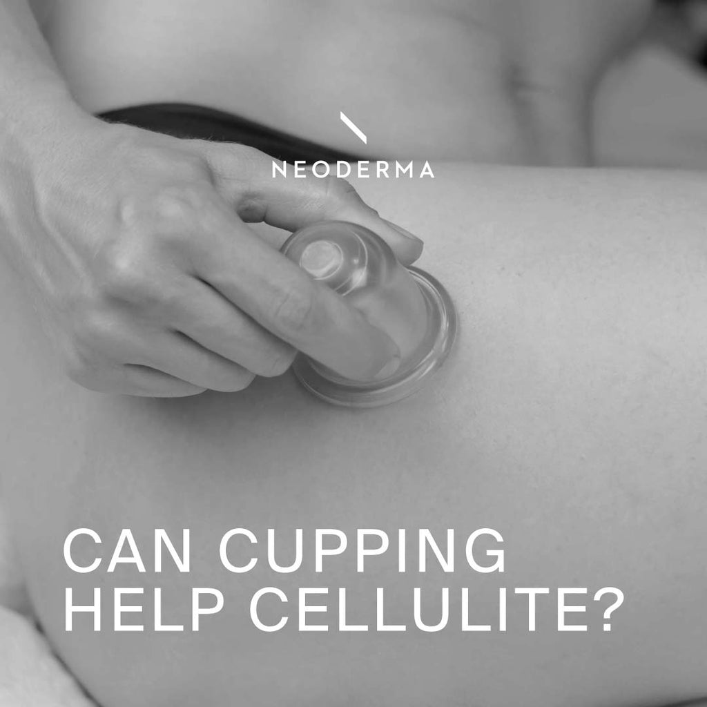 Can Cupping Help Cellulite?