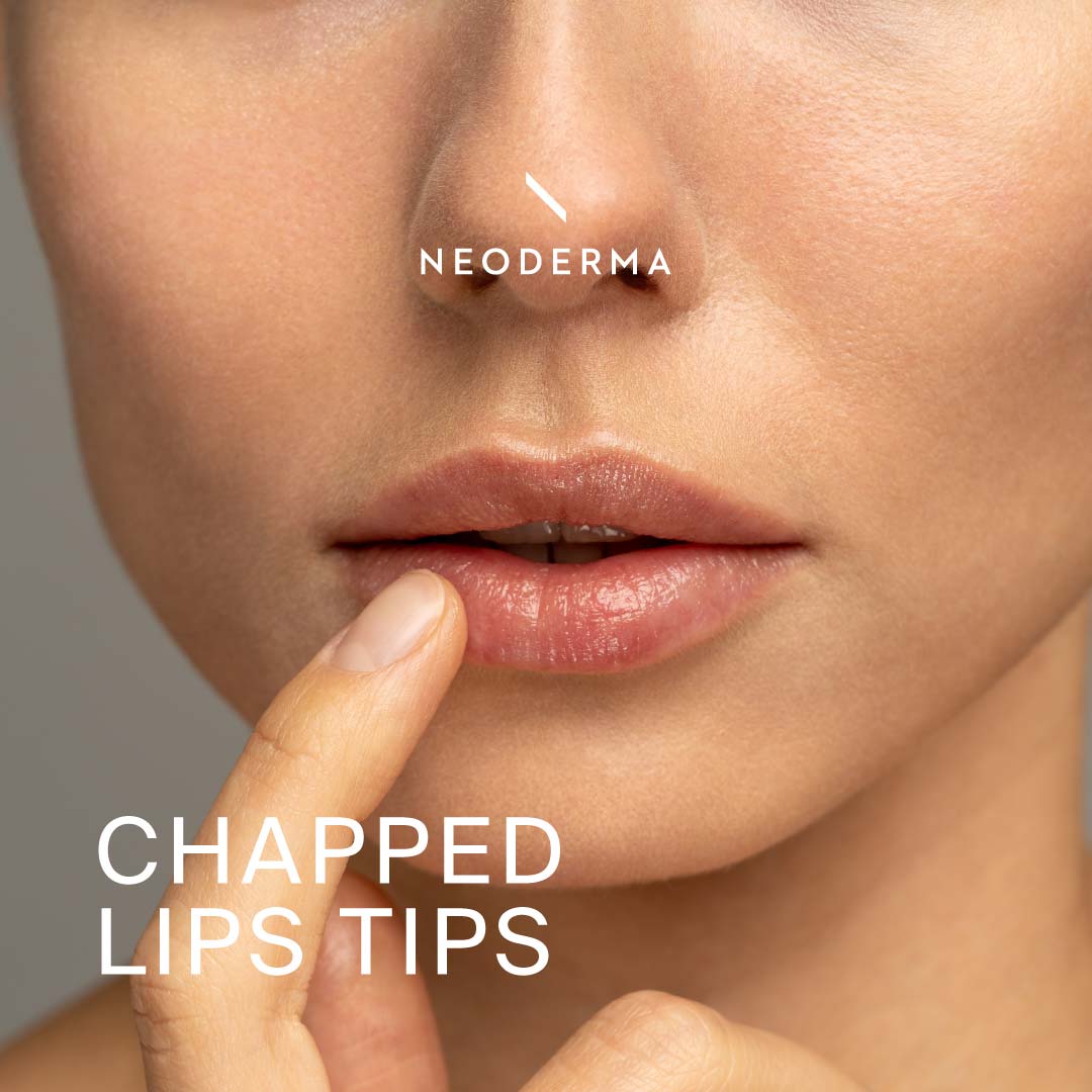 Chapped Lips Tips