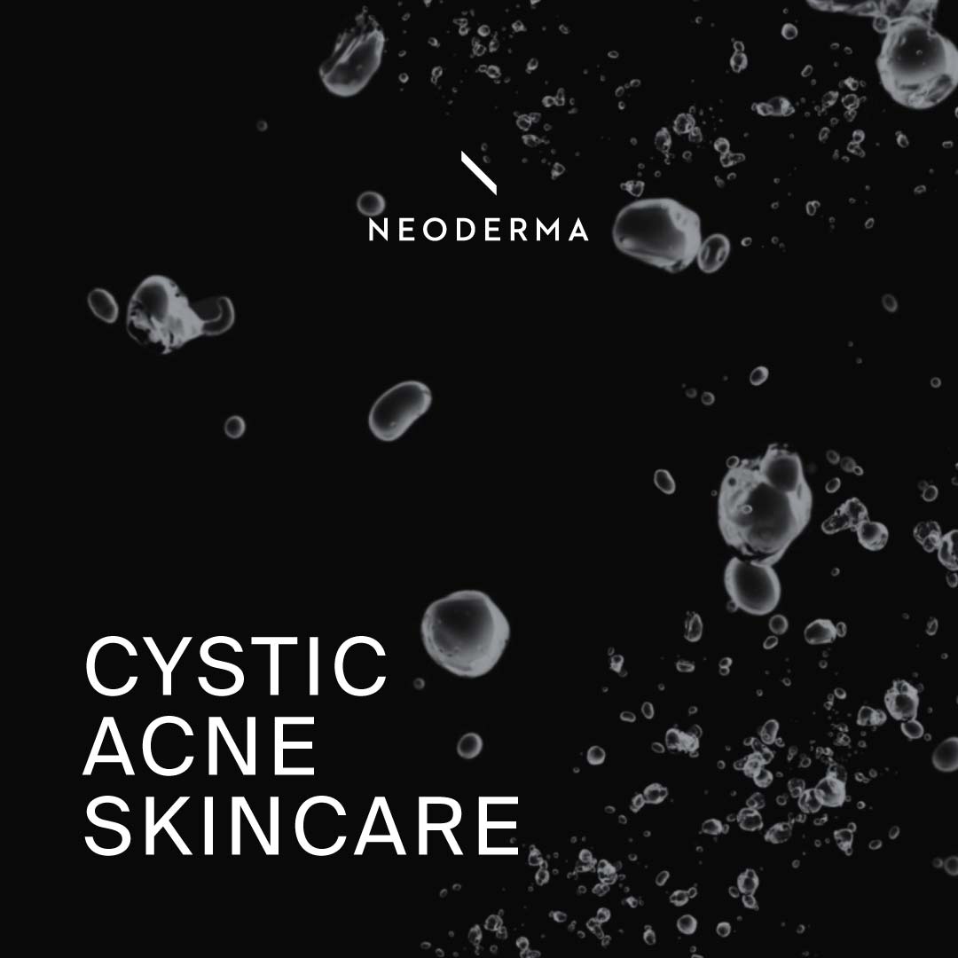 Cystic Acne Skincare