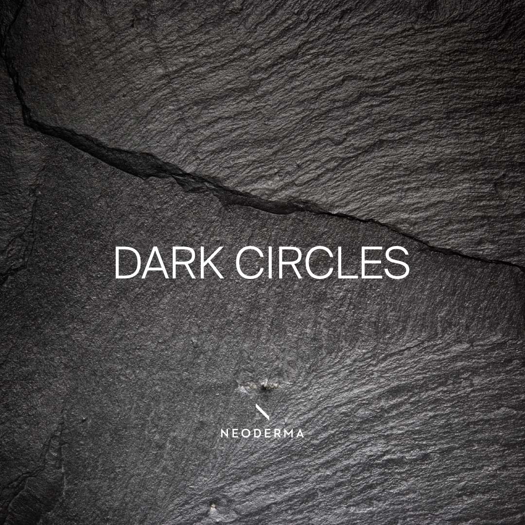Dark Circles