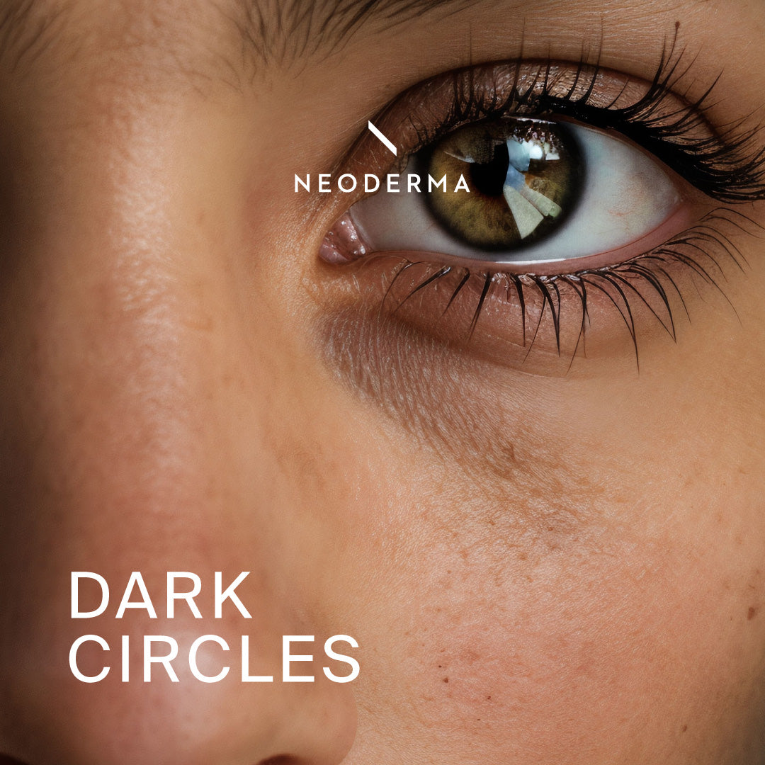 Dark Circles