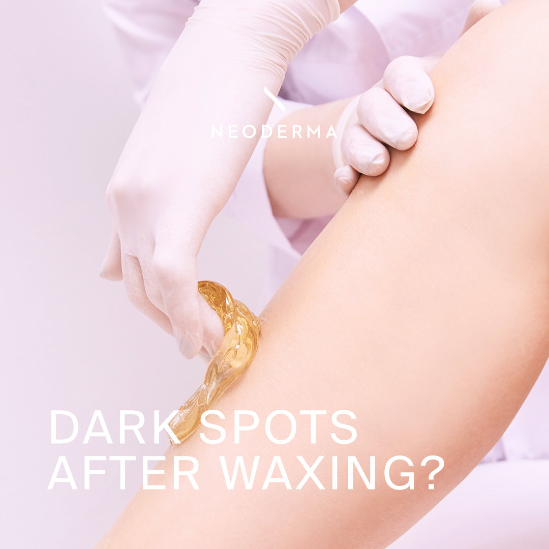 Dark Spots After Waxing