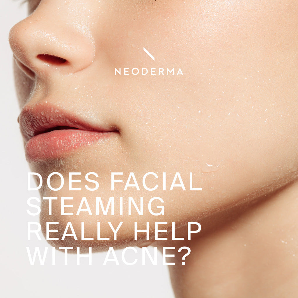 Does facial Steaming Really Help With Acne?