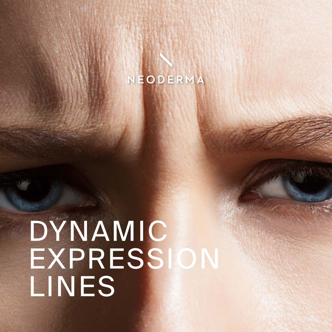 Dynamic Expression Lines