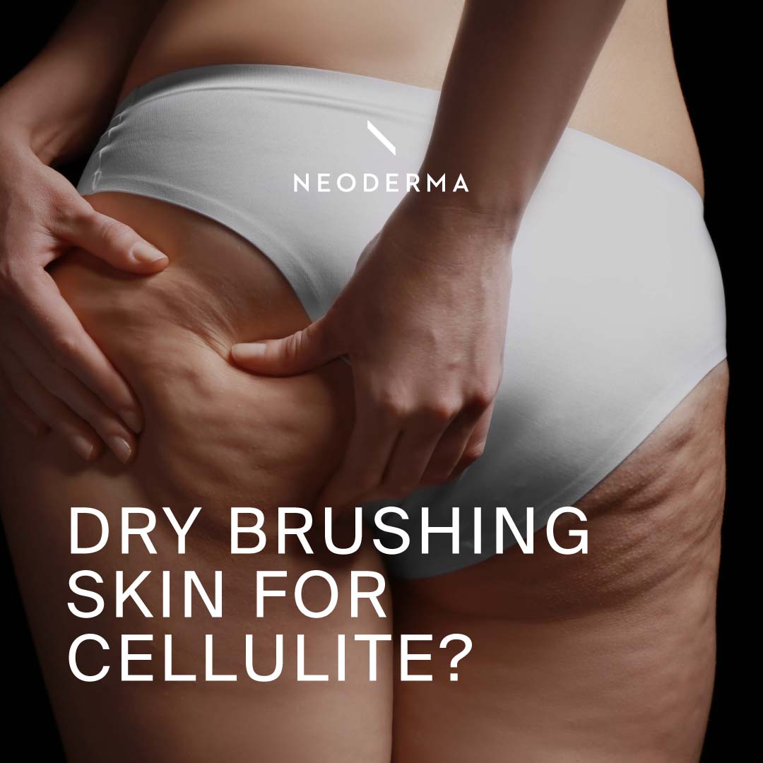 Dry Brushing Skin for Cellulite?