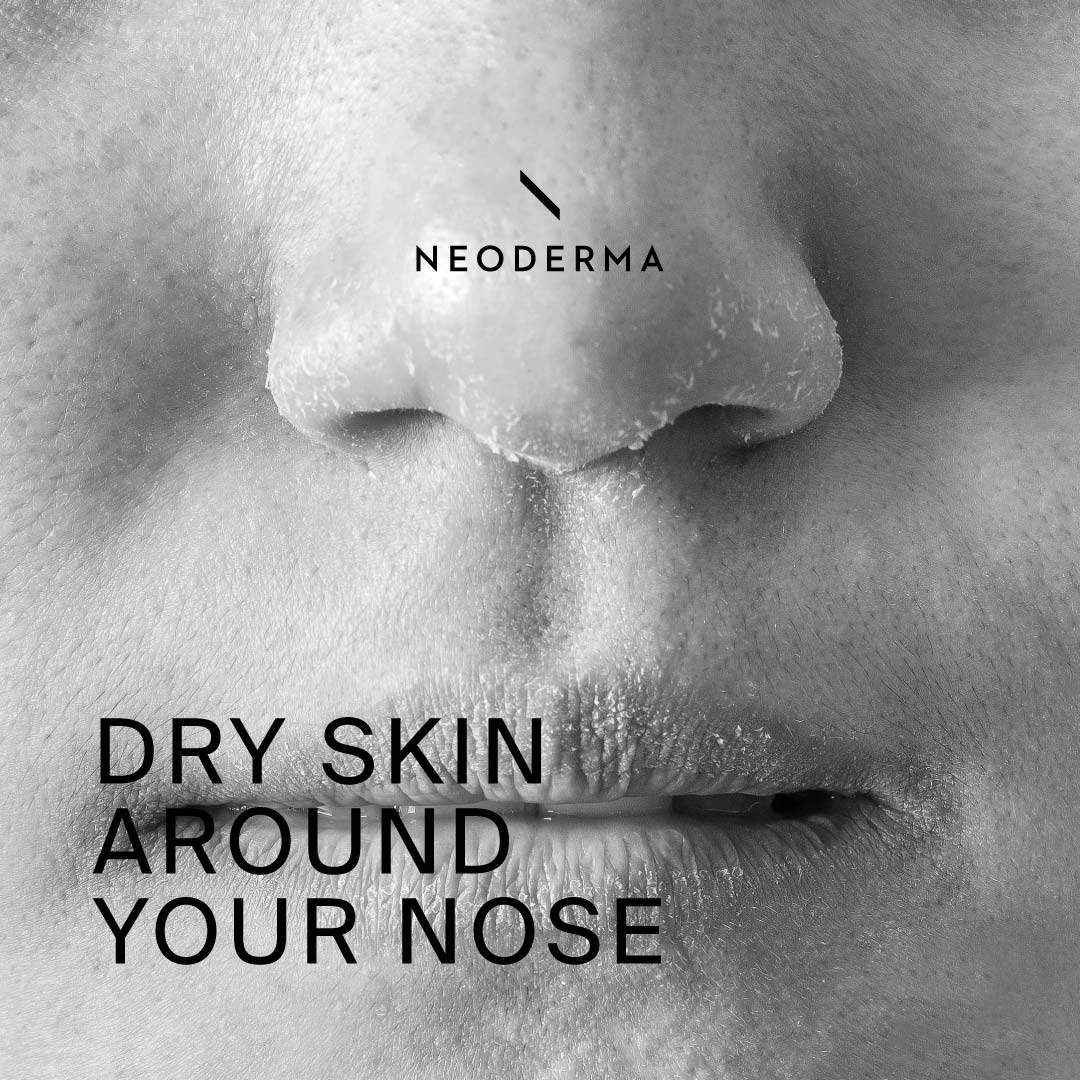 Dry Skin Around Your Nose