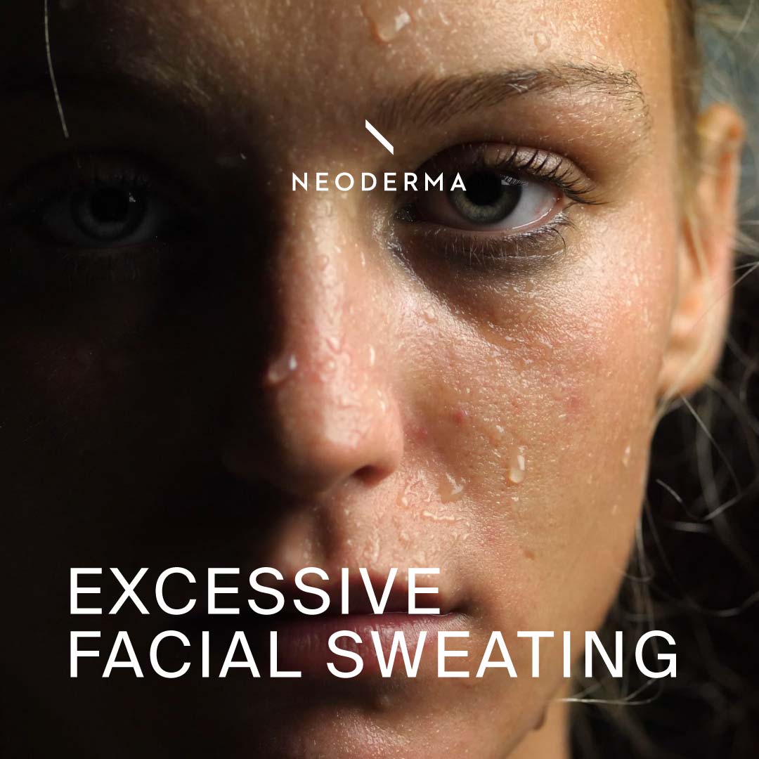 Excessive Facial Sweating