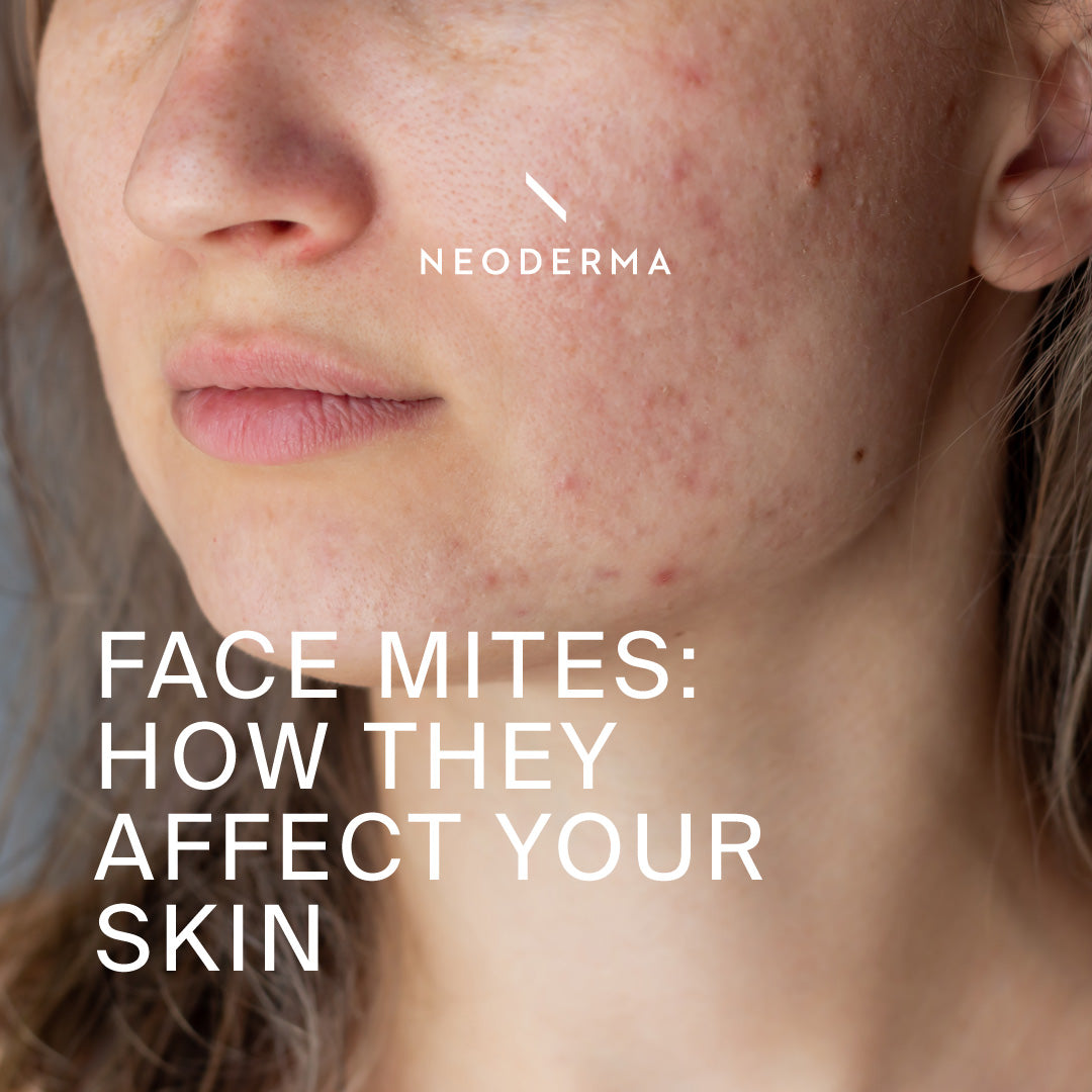 Face Mites: How They Affect Your Skin