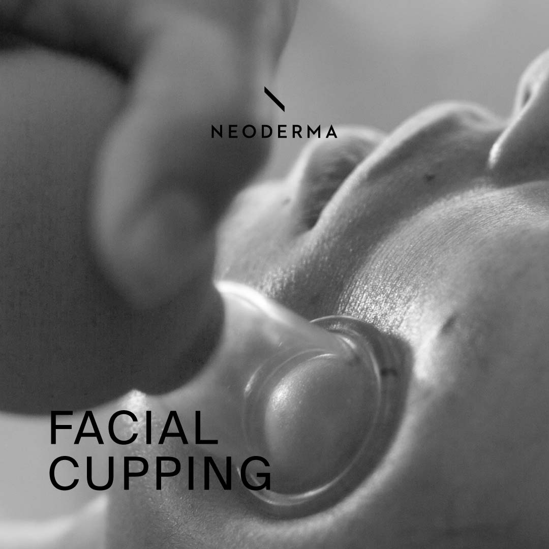 Facial Cupping