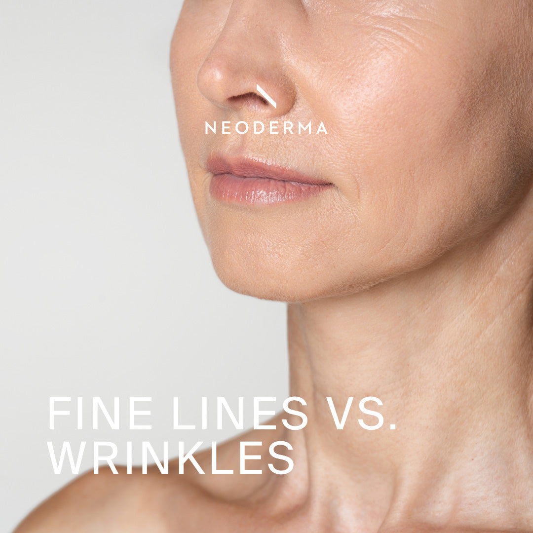 Fine Lines Vs. Wrinkles