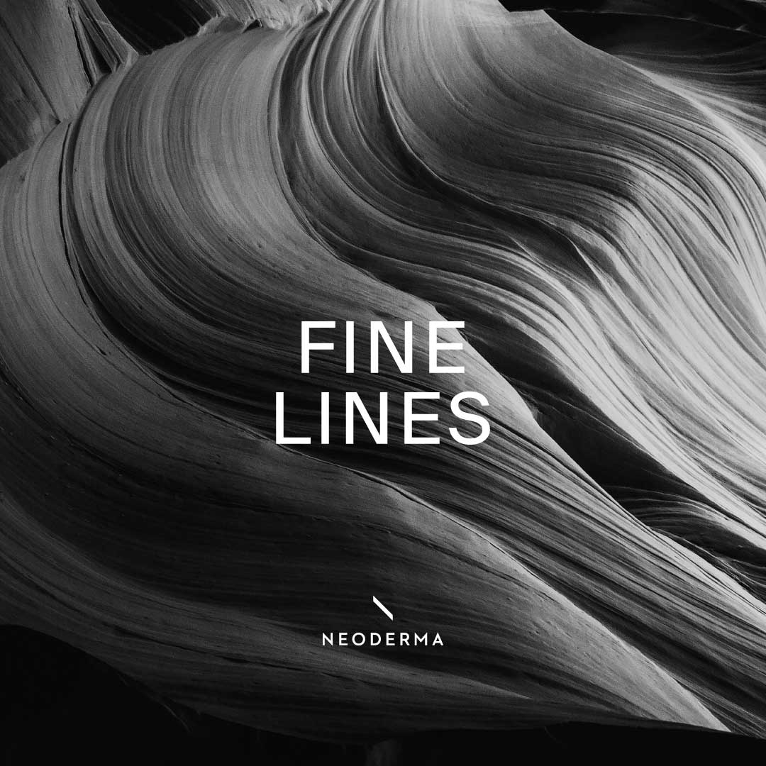 Fine Lines
