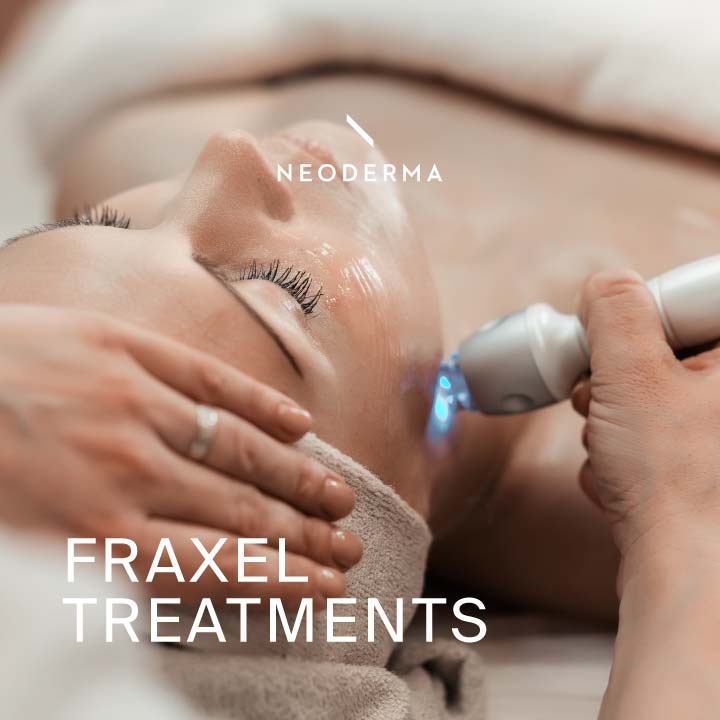 Fraxel Treatments