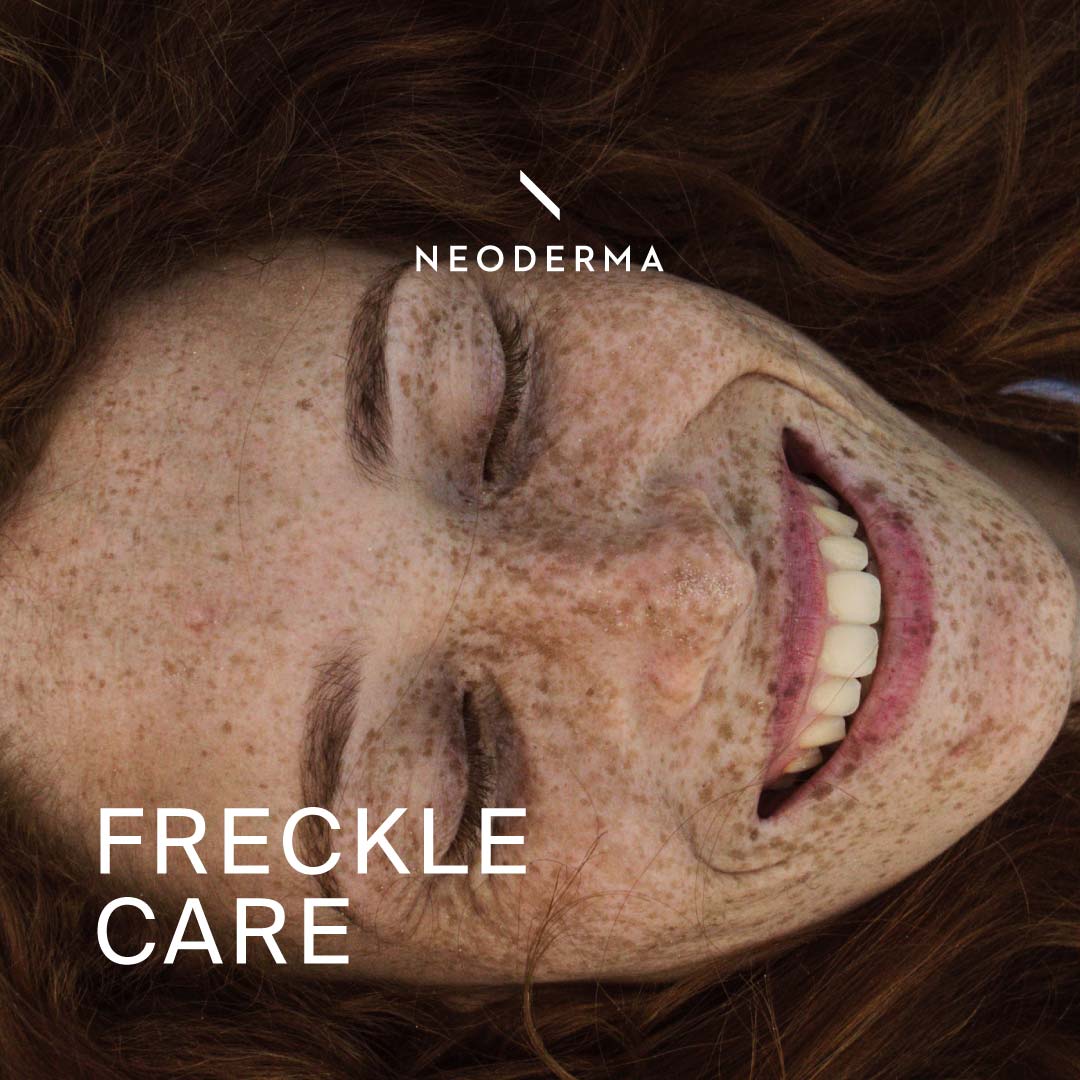 Freckle Care