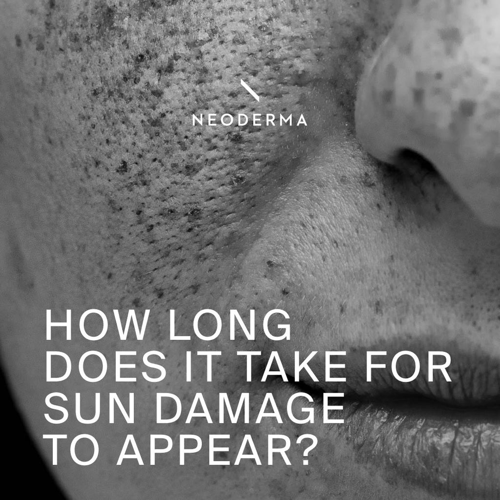 How Long Does it Take for Sun Damage to Appear?