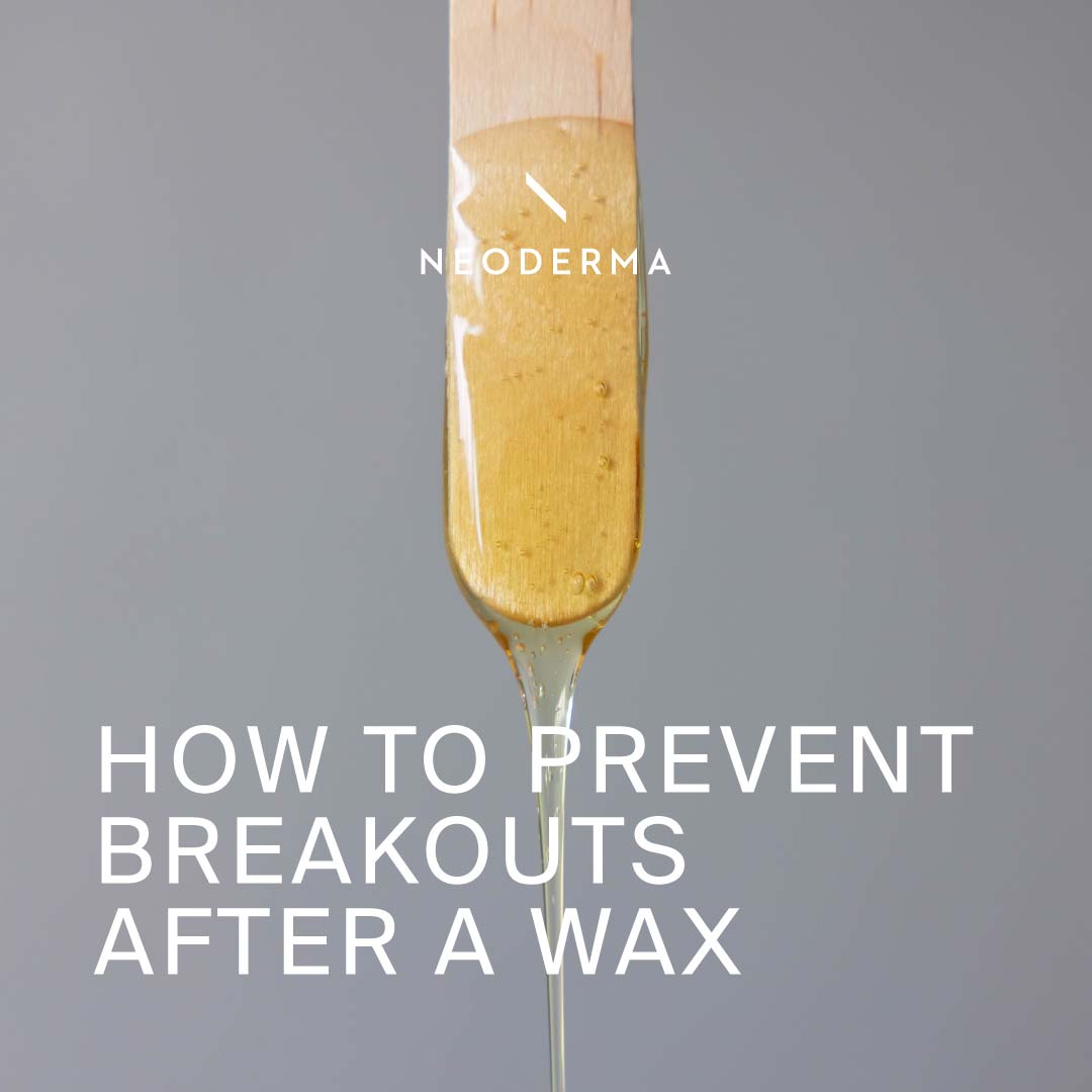 How to Prevent Breakouts After a Wax
