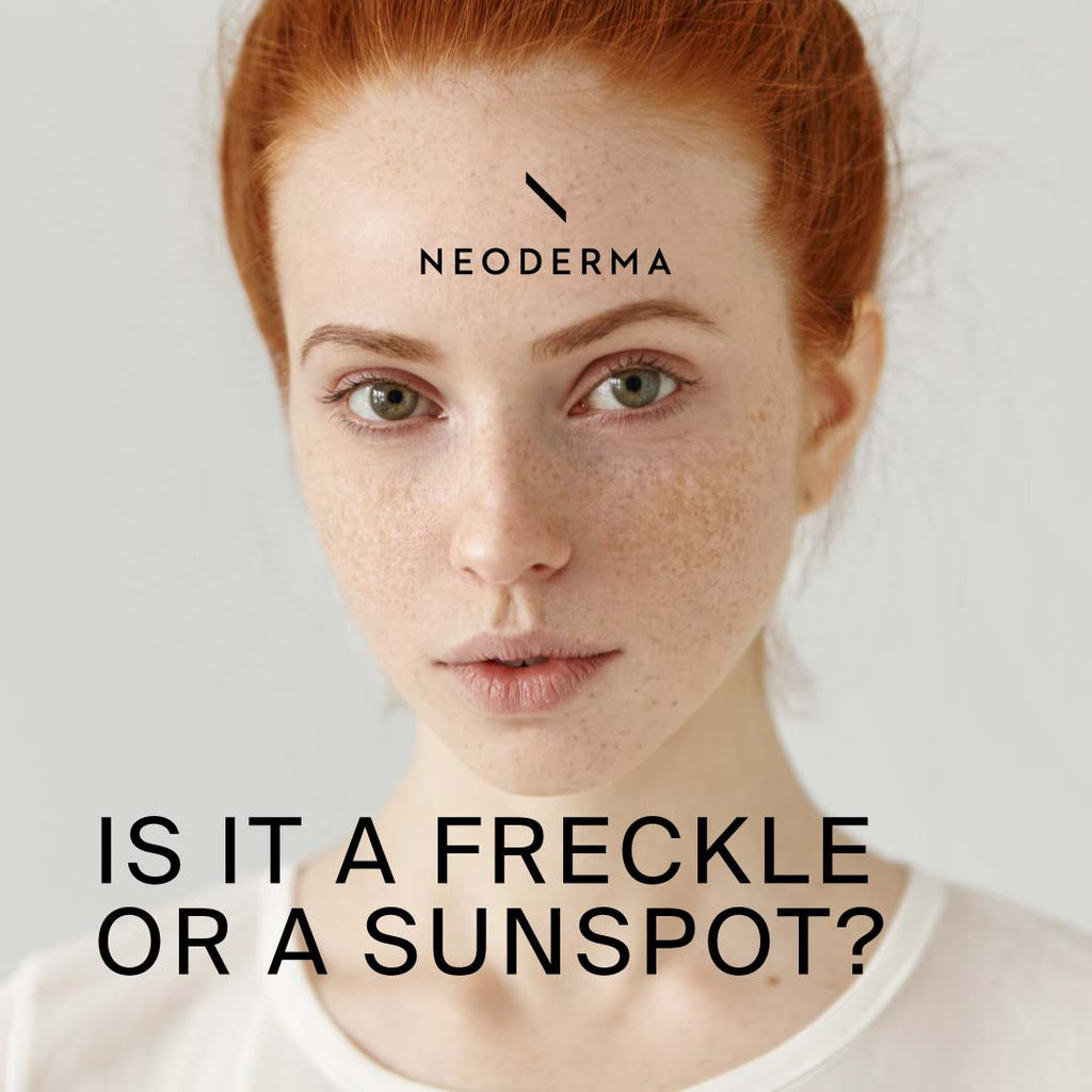 Is it a Freckle or a Sunspot?