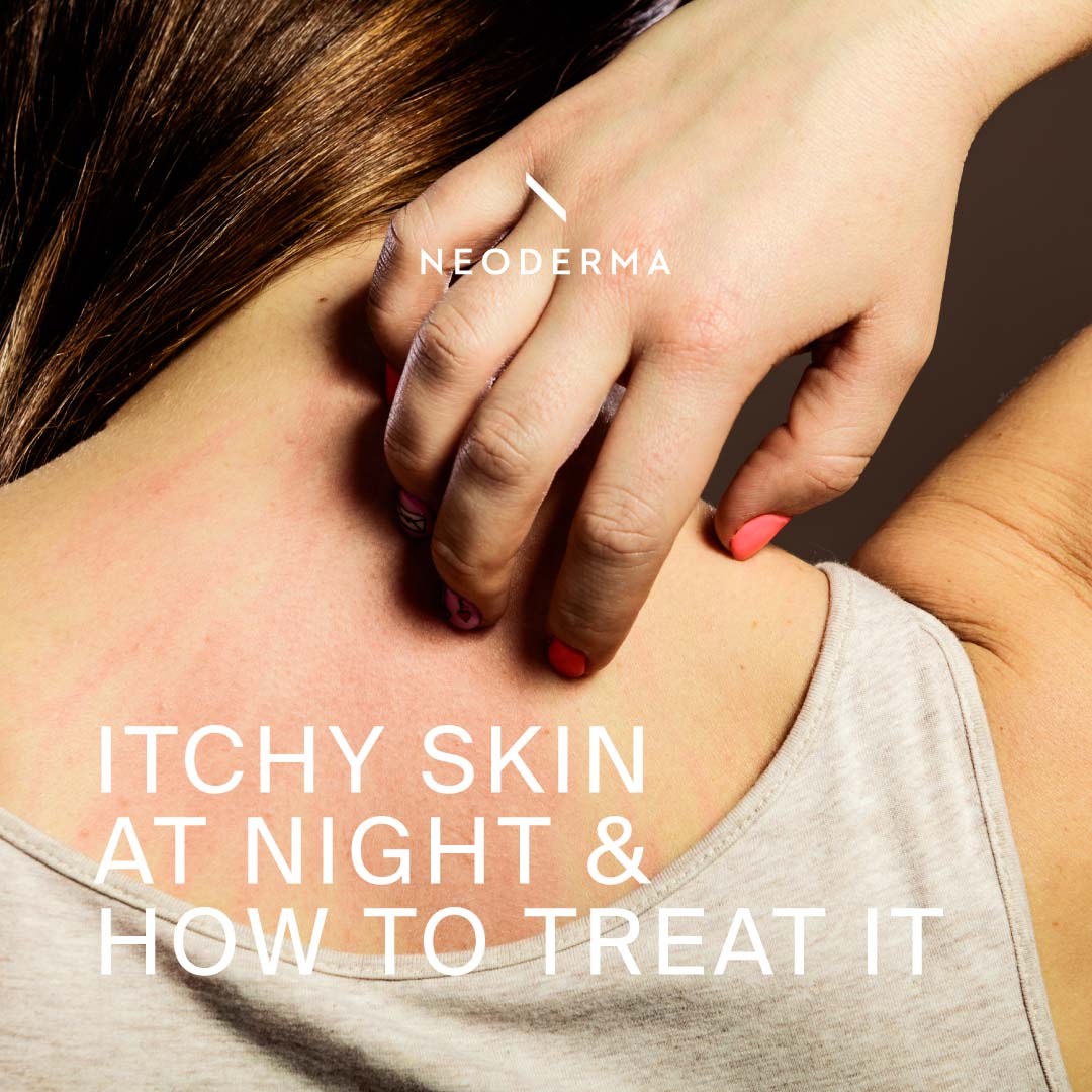 Itchy Skin at Night & How to Treat It