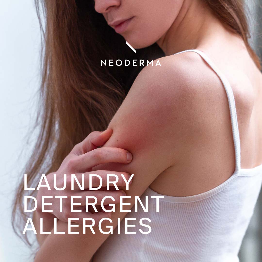 Laundry Detergent Allergies