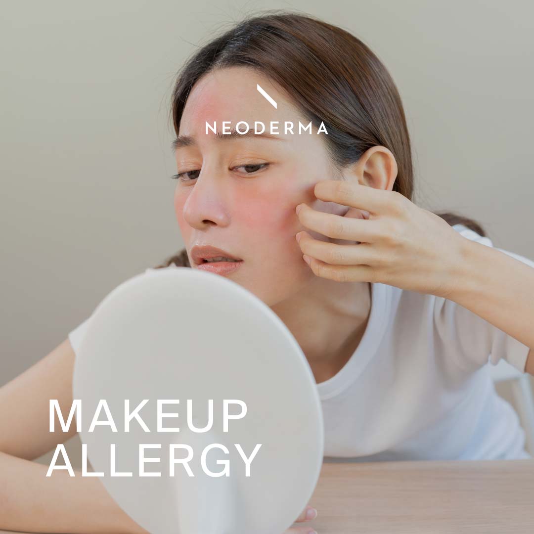 Makeup Allergy