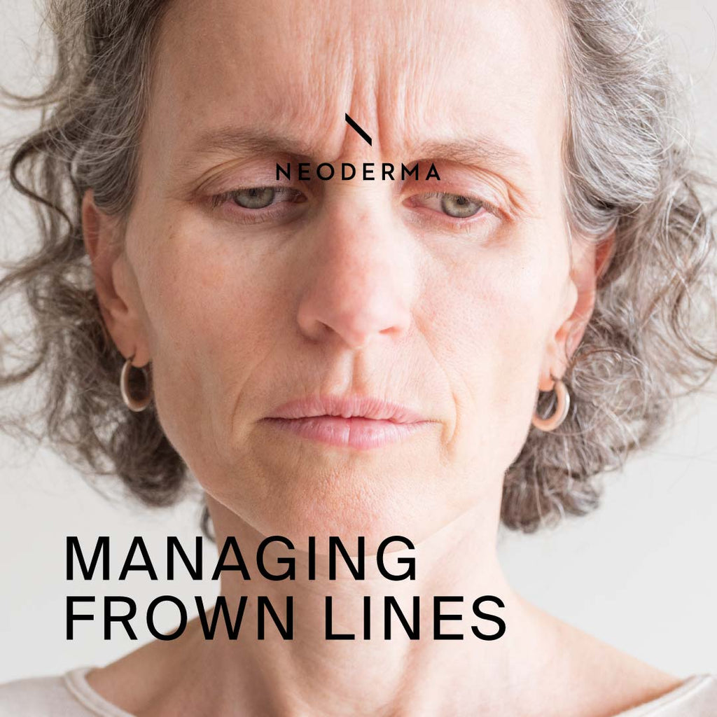 Managing Frown Lines