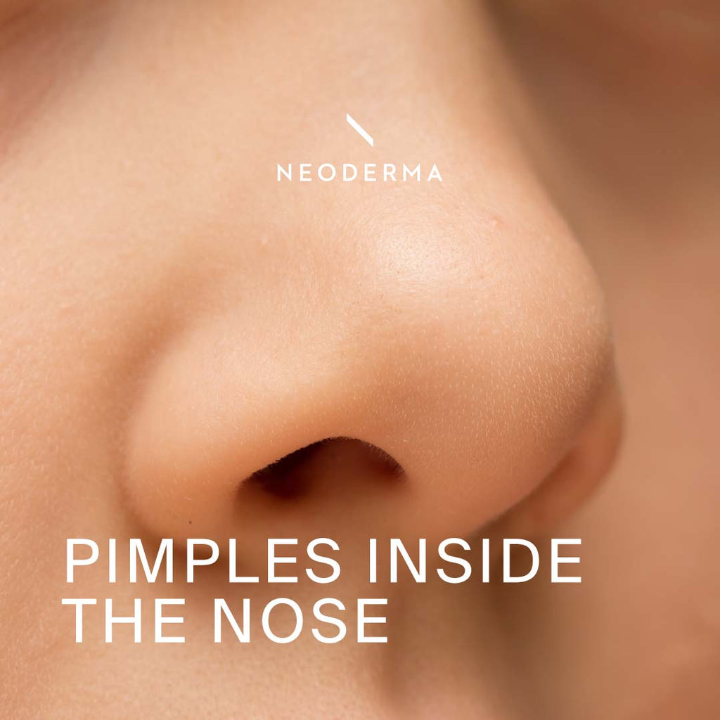 Pimples Inside the Nose