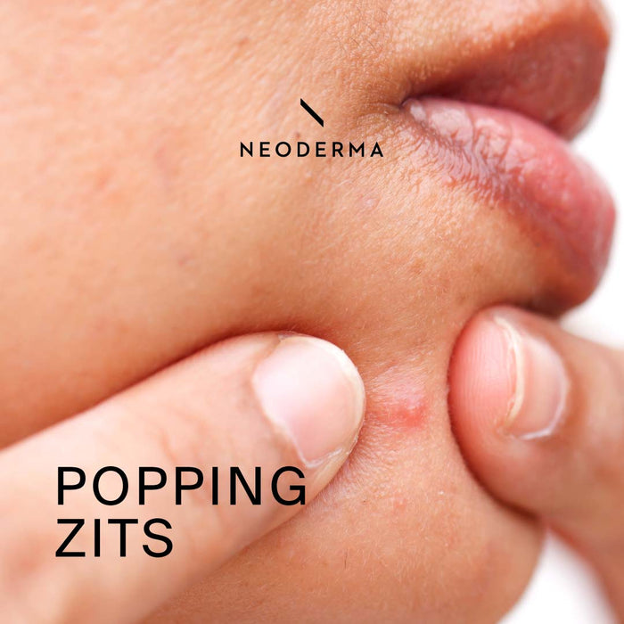 Popping Zits