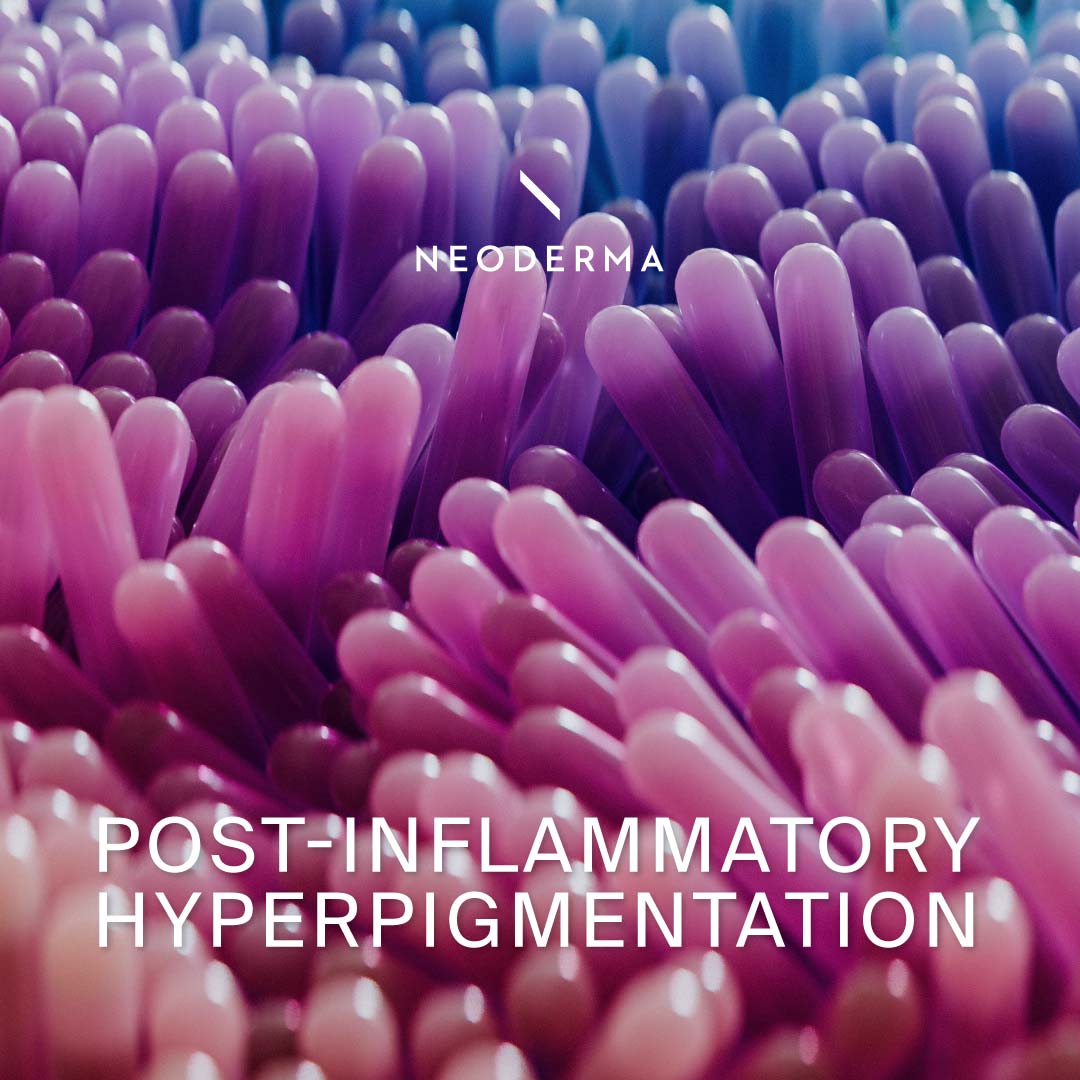 Post-Inflammatory Hyperpigmentation