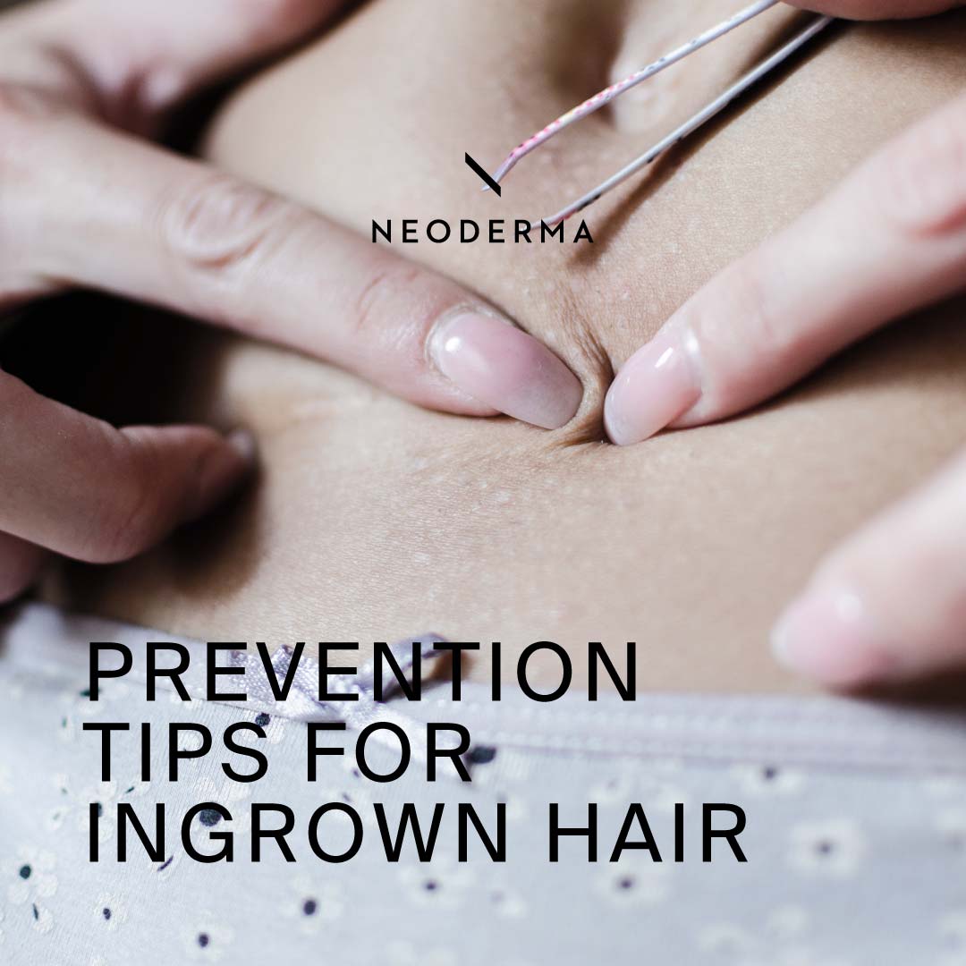 Prevention Tips for Ingrown Hair