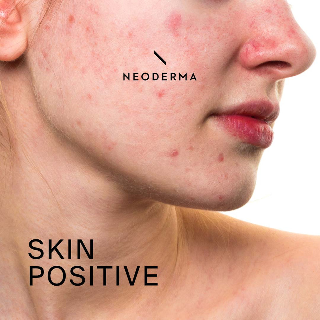 Skin Positive