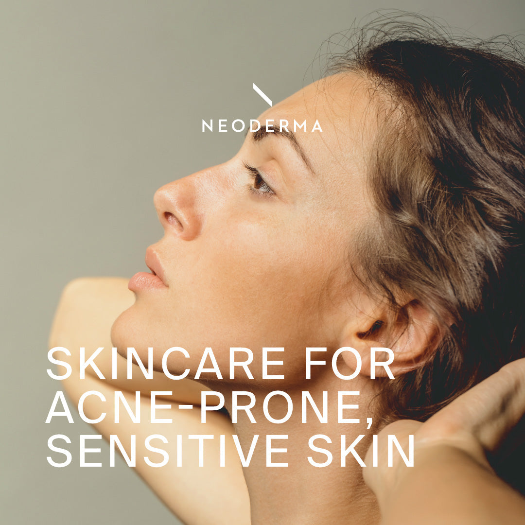 Your 5-Step Skin Care Routine For Acne-Prone, Sensitive Skin