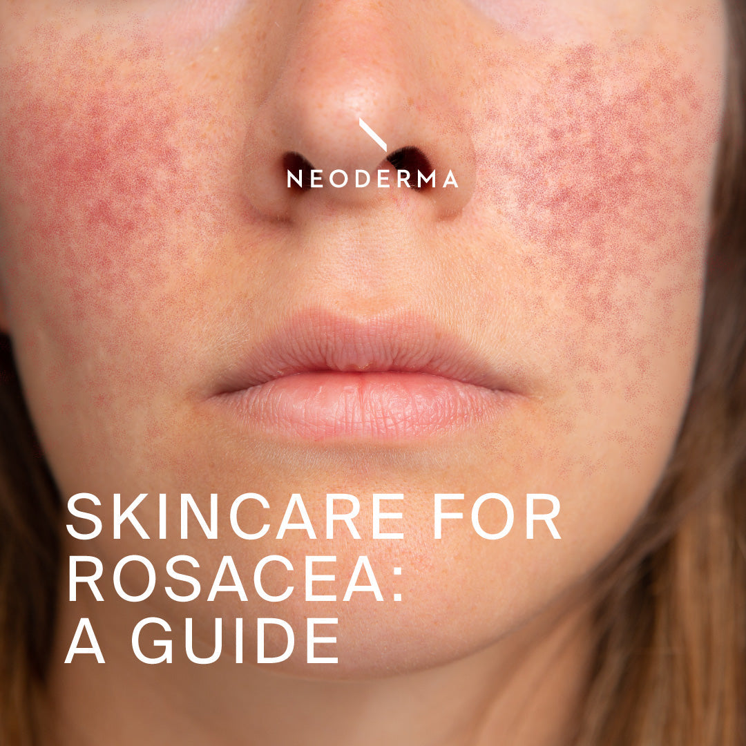 How To Build A Rosacea-Friendly Skincare Routine: Skincare For red, Sensitive Skin