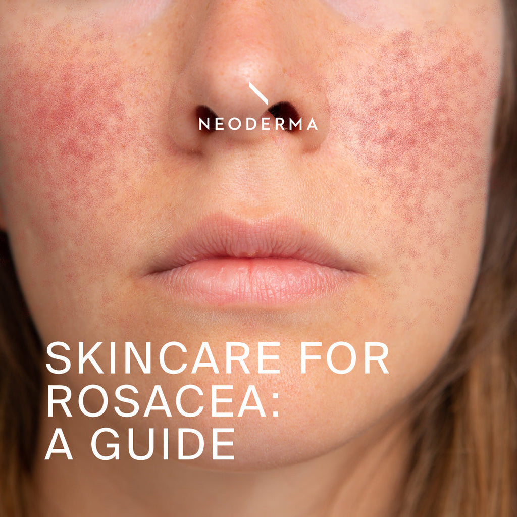 How To Build A Rosacea-Friendly Skincare Routine: Skincare For red, Sensitive Skin