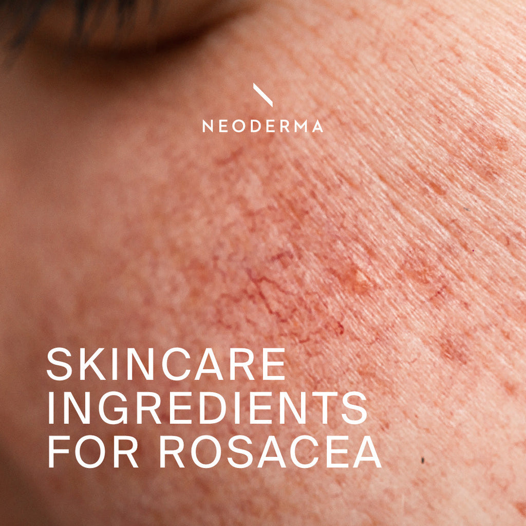 Skincare Ingredients for Rosacea