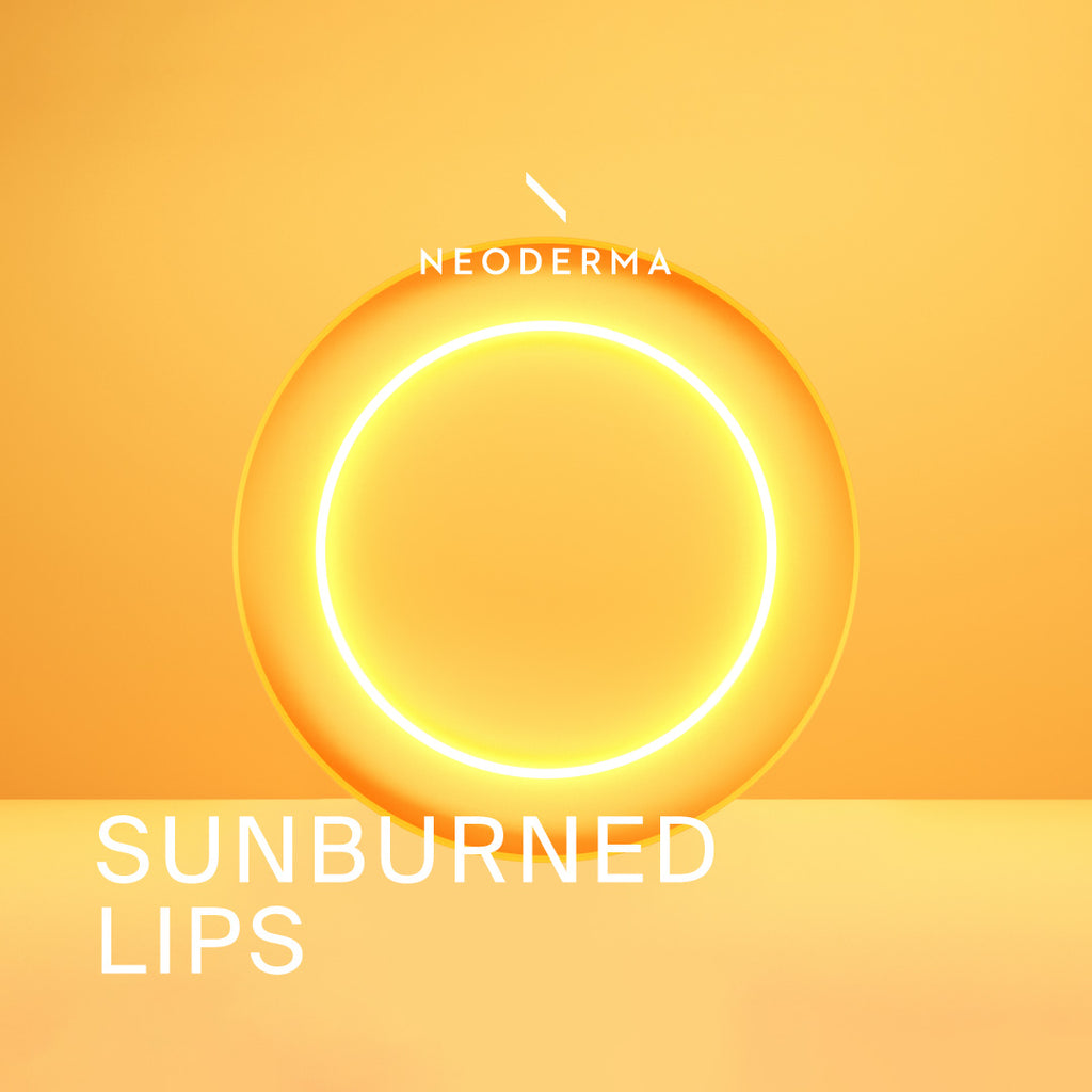 Sunburned Lips