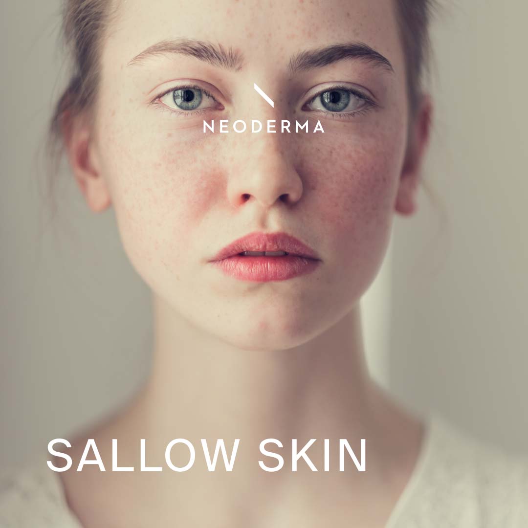 Sallow Skin
