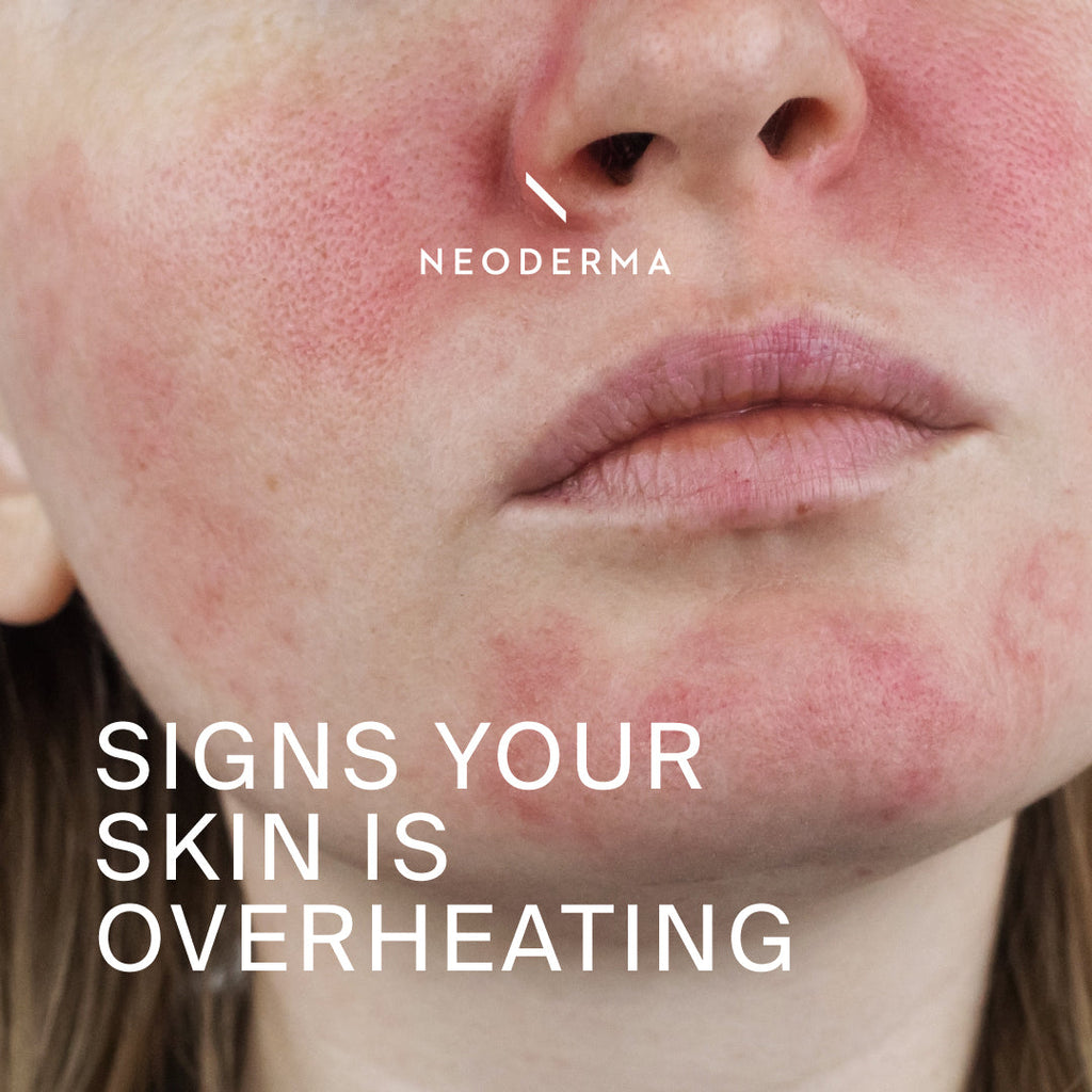 Signs Your Skin Is Overheating