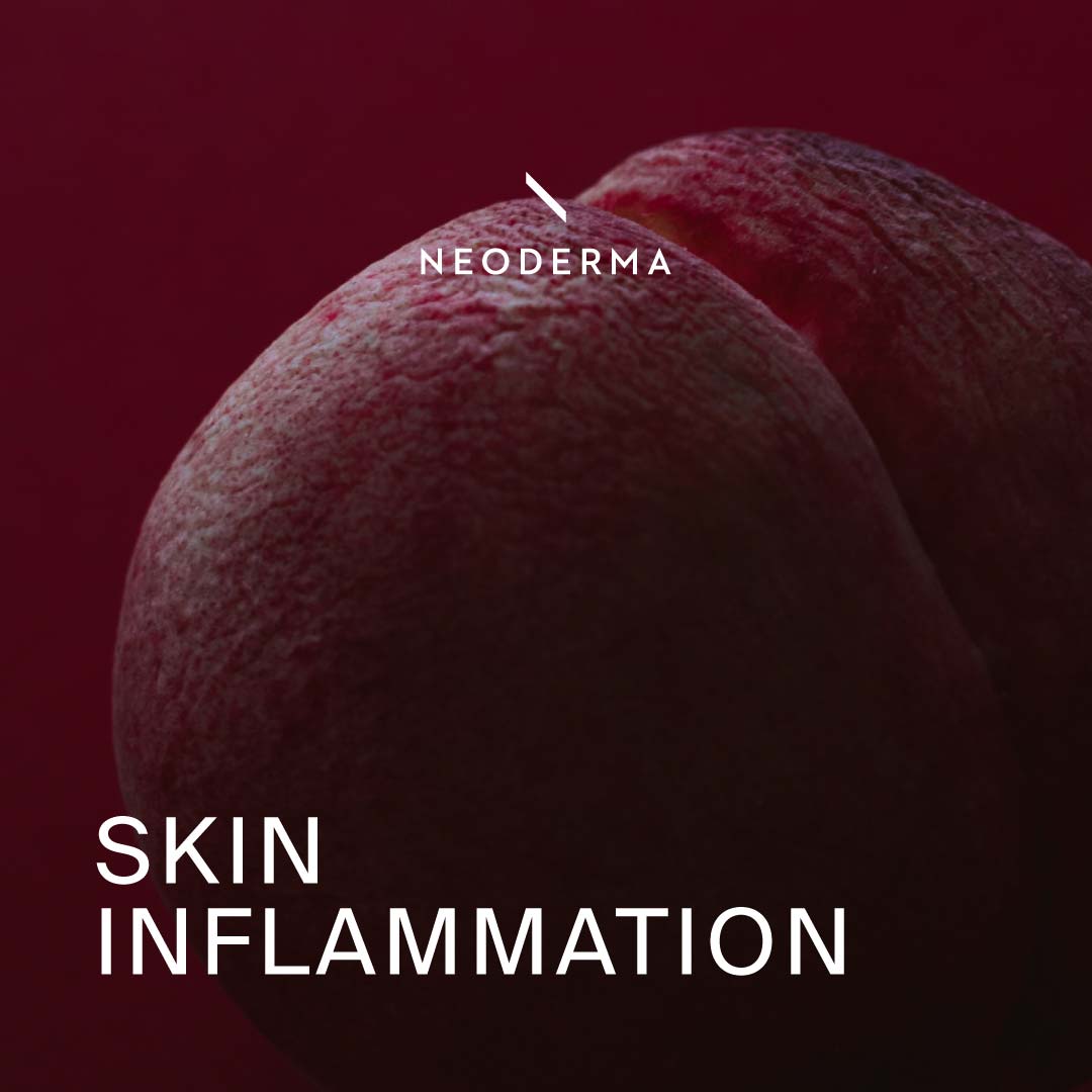 Skin Inflammation