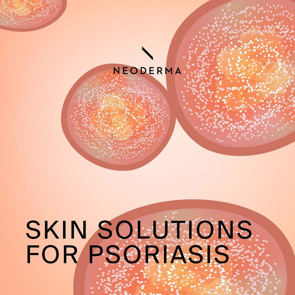 Skin Solutions for Psoriasis