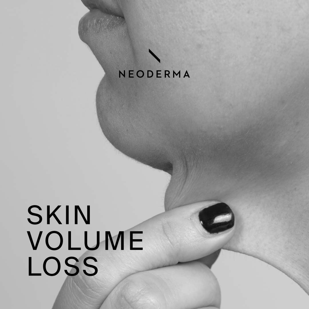 Skin Volume Loss