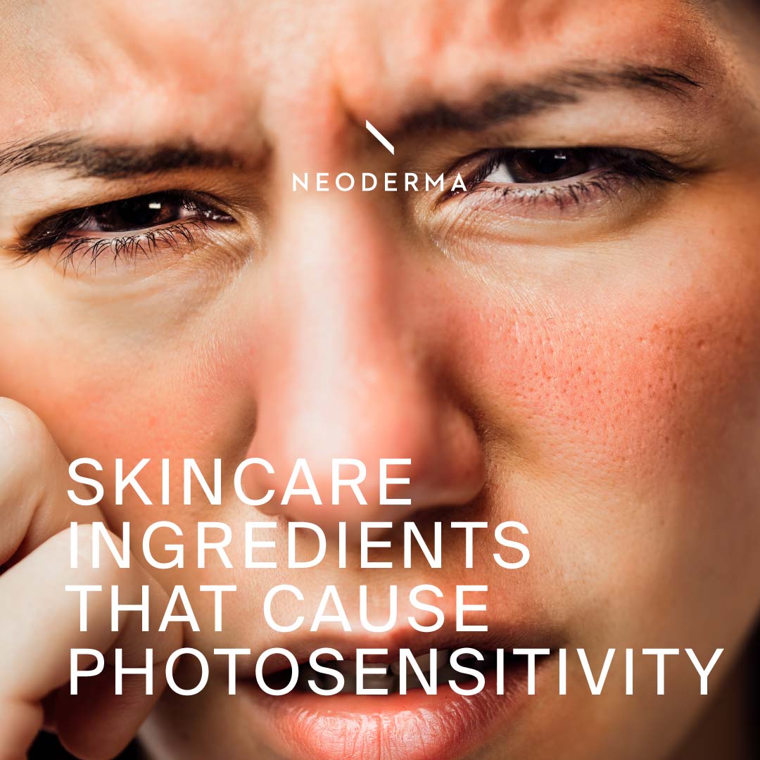 Skincare Ingredients That Cause Photosensitivity