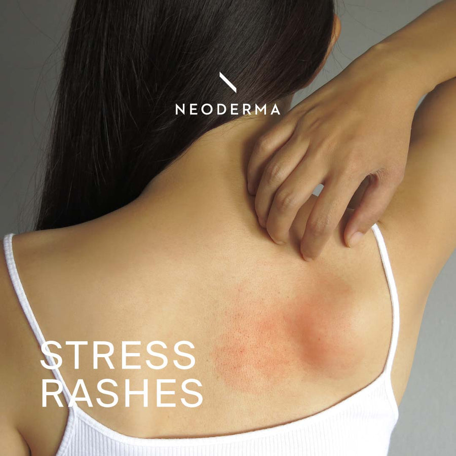 Stress Rashes