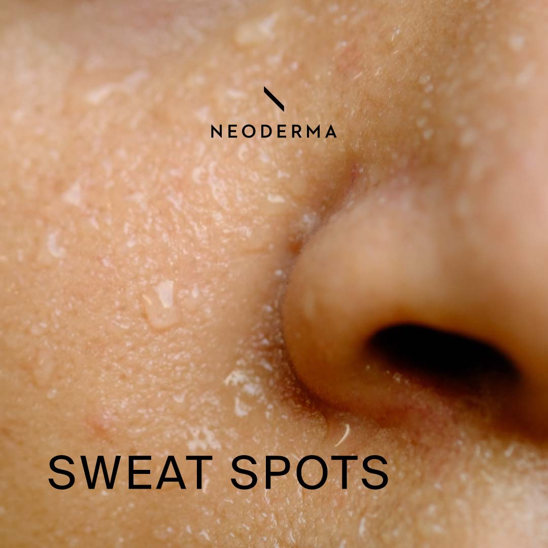 Sweat Spots