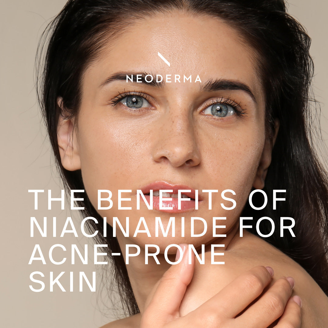 The Benefits Of Niacinamide for Acne-Prone Skin