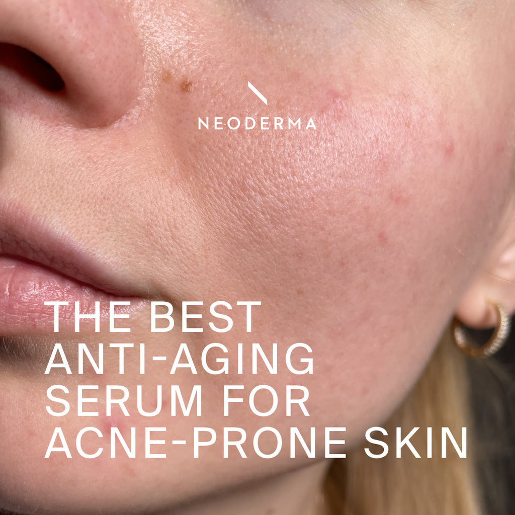 The Best Anti-Aging Serum For Acne-Prone Skin