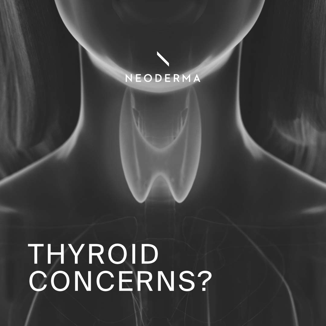 Thyroid Concerns